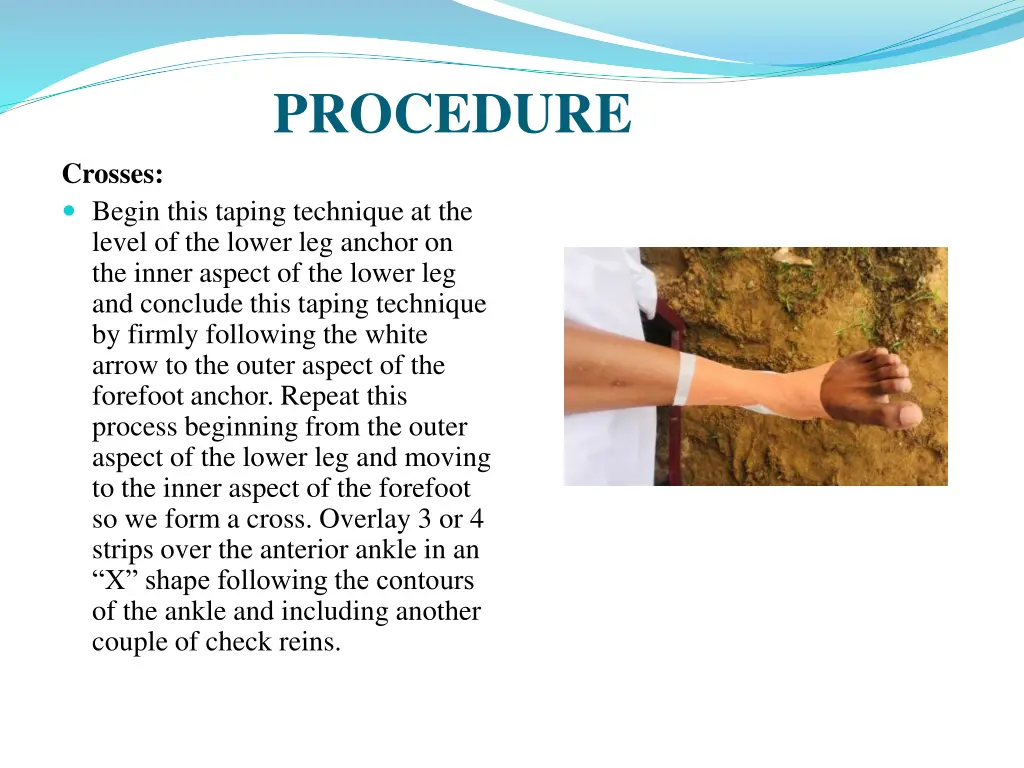 procedure 3