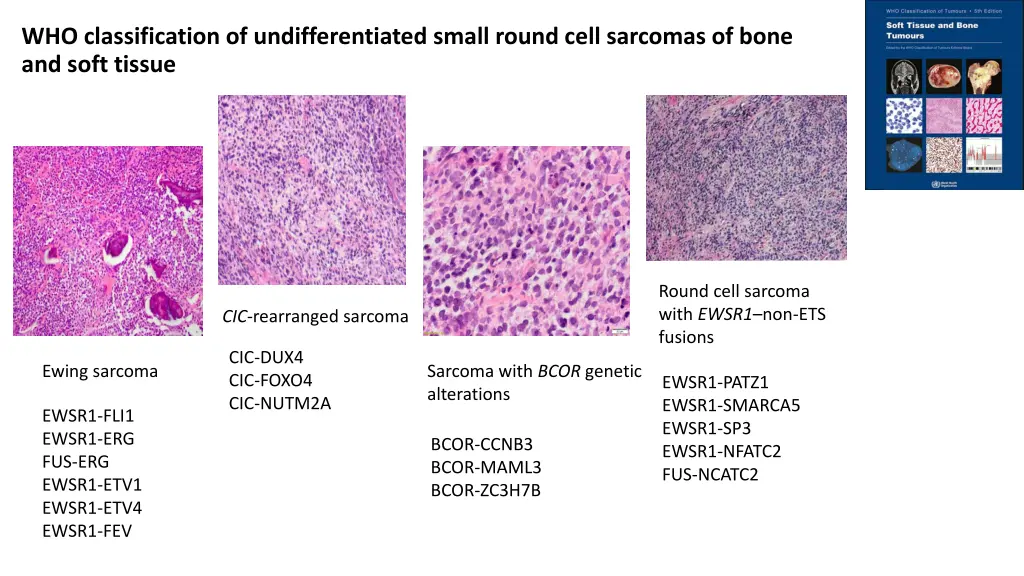 who classification of undifferentiated small