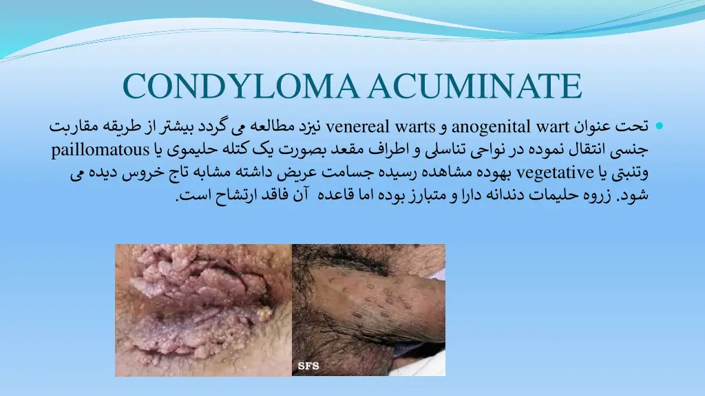 condyloma acuminate venereal warts paillomatous