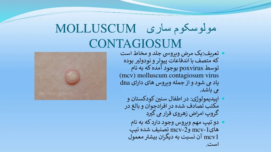 molluscum contagiosum