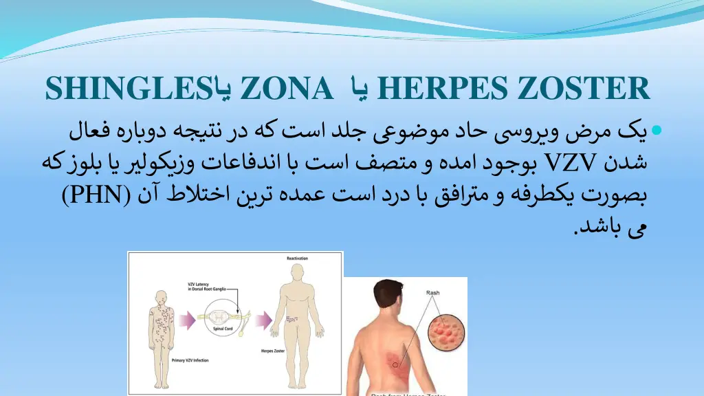 shingles phn