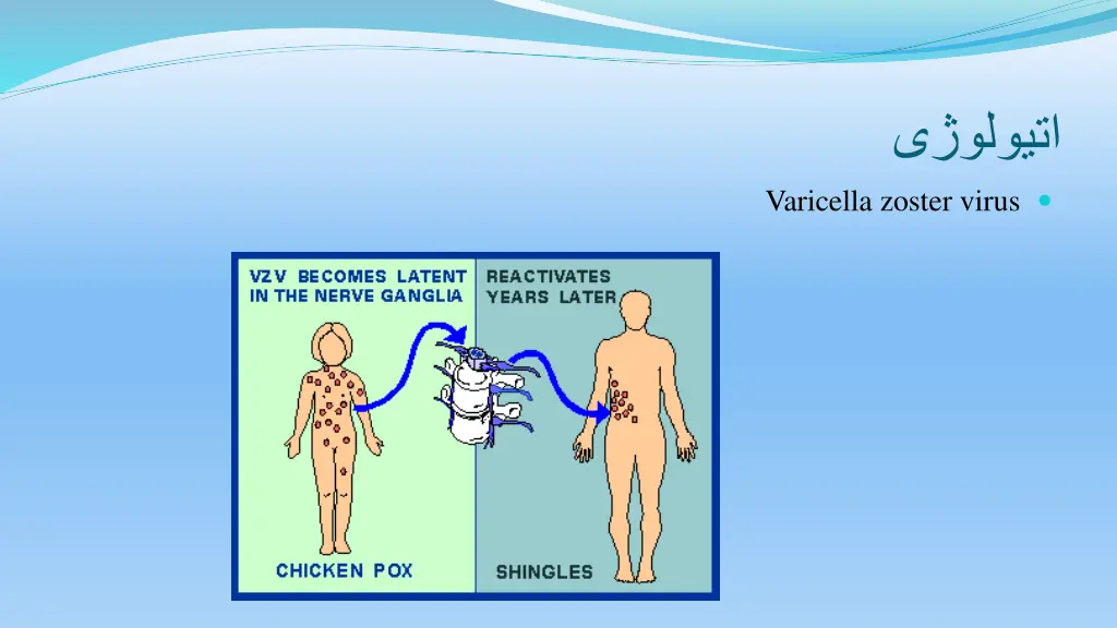 slide14