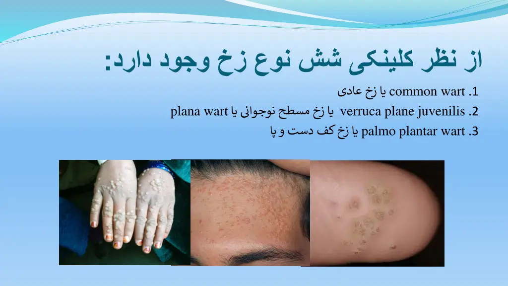 slide25