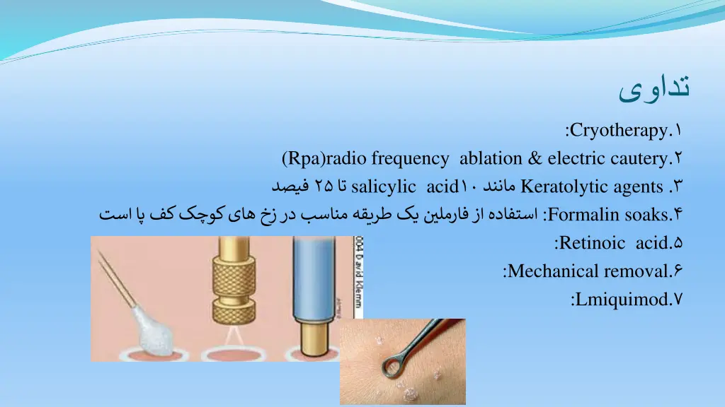 slide34