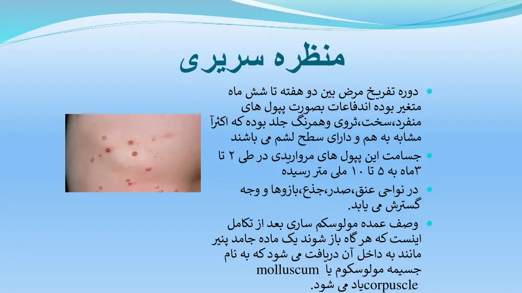 slide36