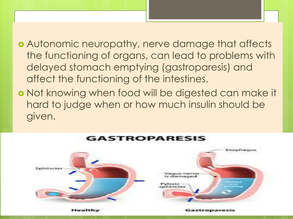autonomic neuropathy nerve damage that affects