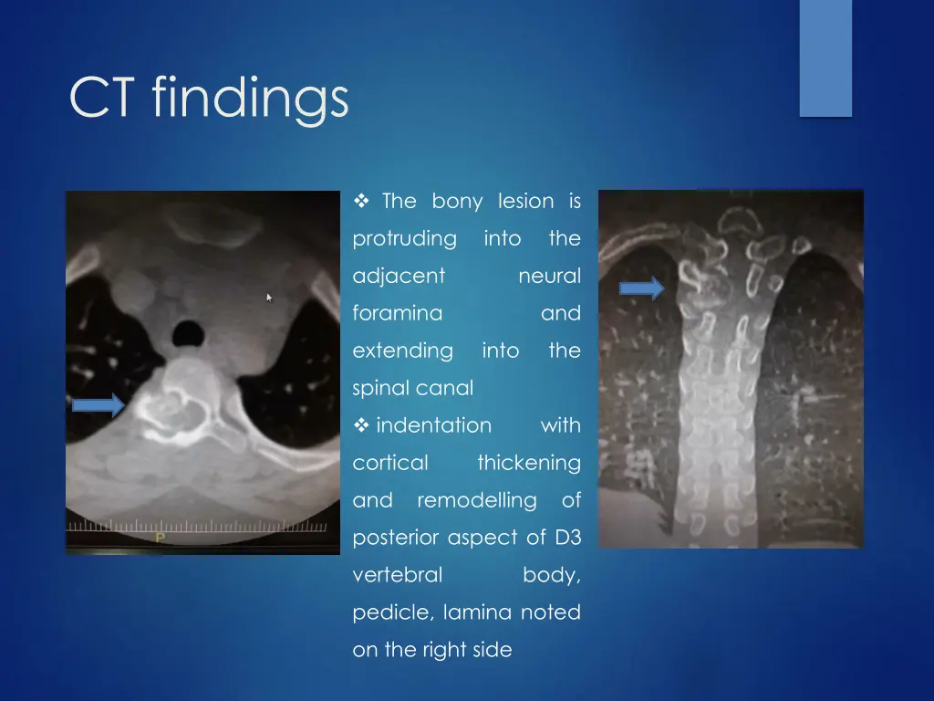 ct findings 1