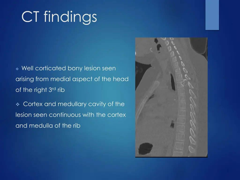 ct findings