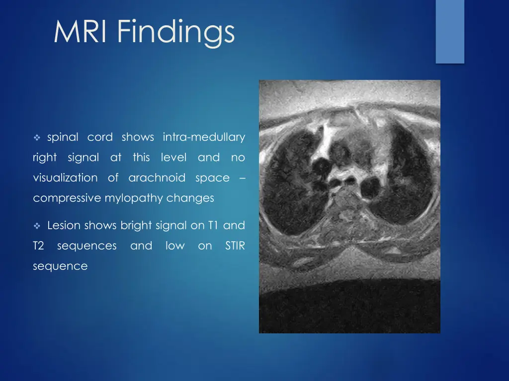 mri findings 1