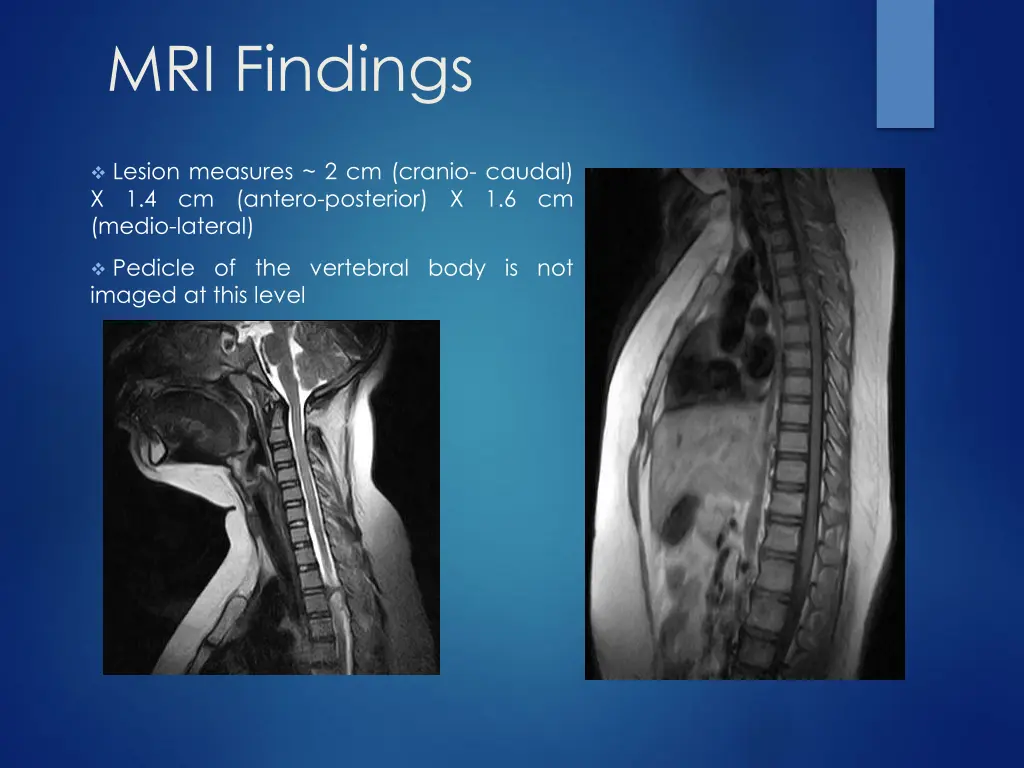 mri findings