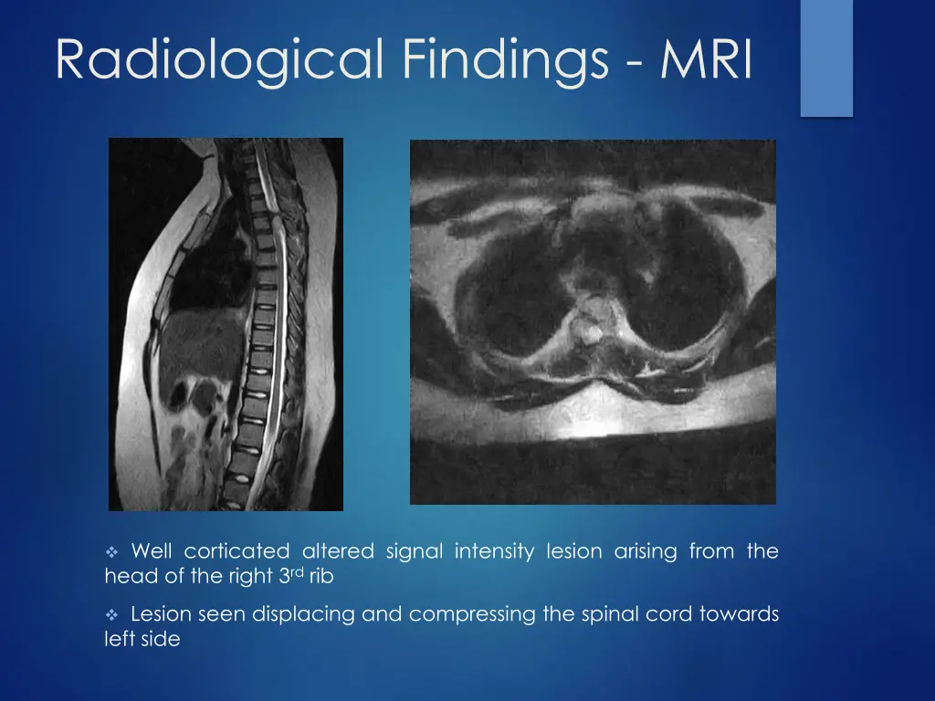 radiological findings mri