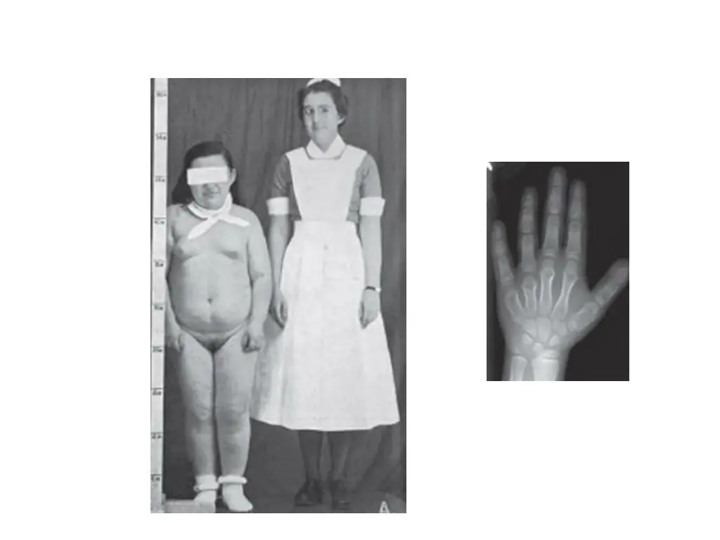 slide19