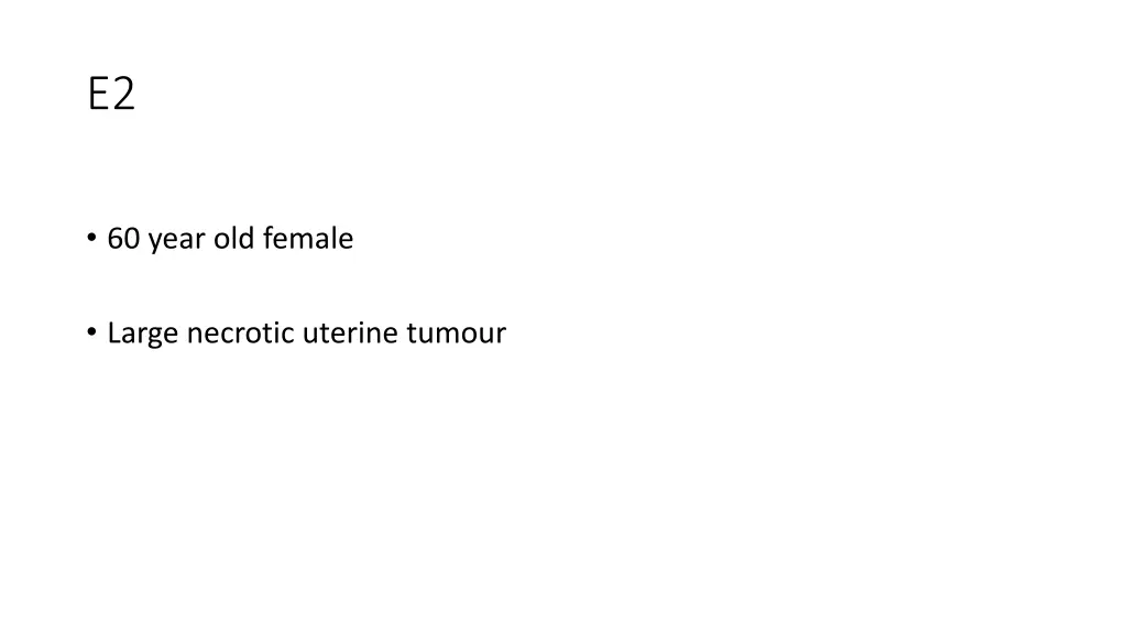 slide13