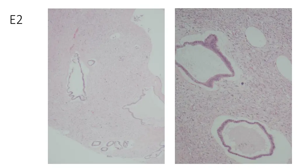 slide14