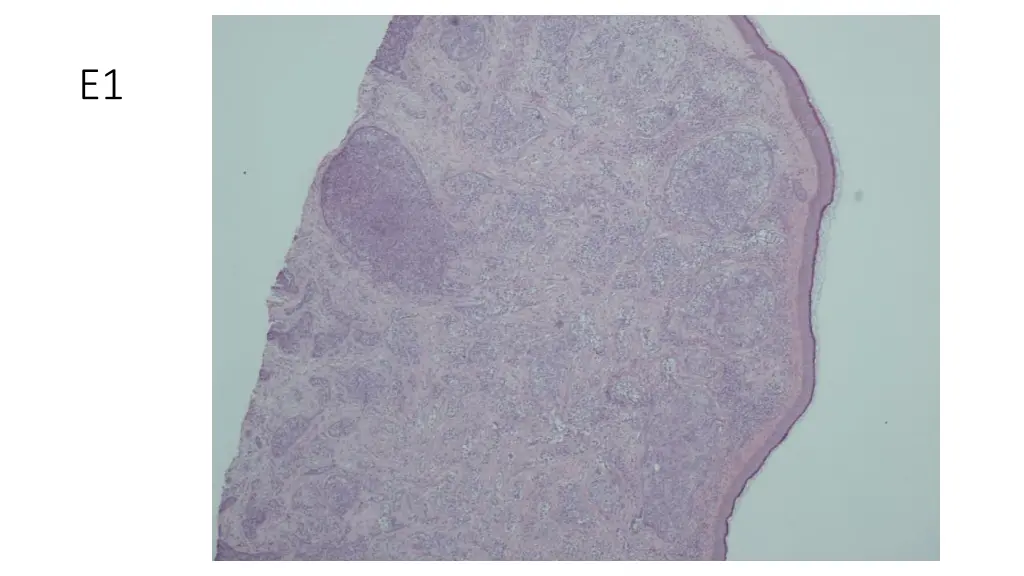 slide3