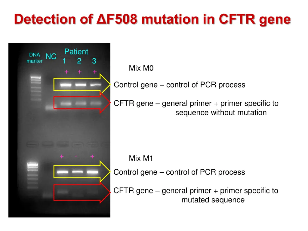 detection of f508 mutation in cftr gene 1