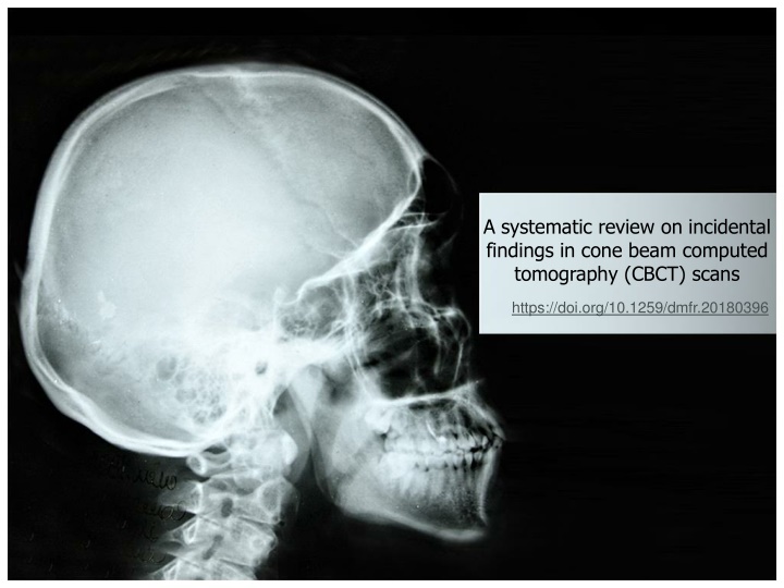 a systematic review on incidental findings