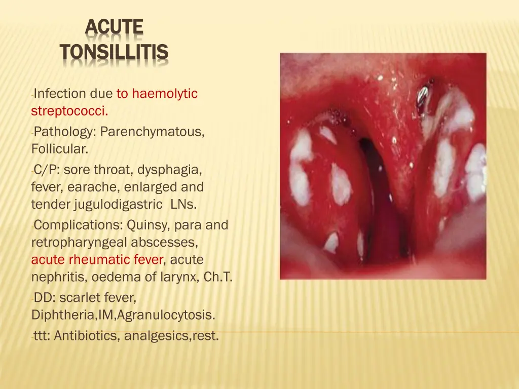 acute acute tonsillitis tonsillitis