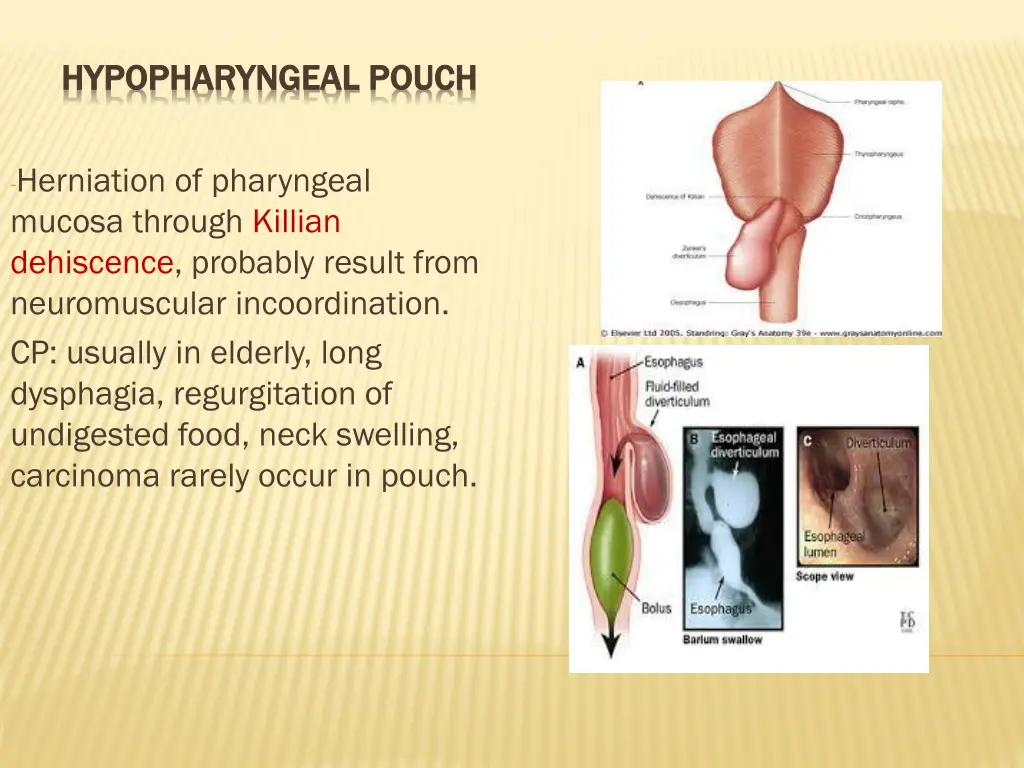 hypopharyngeal hypopharyngeal pouch