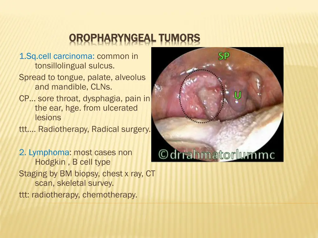 oropharyngeal oropharyngeal tumors