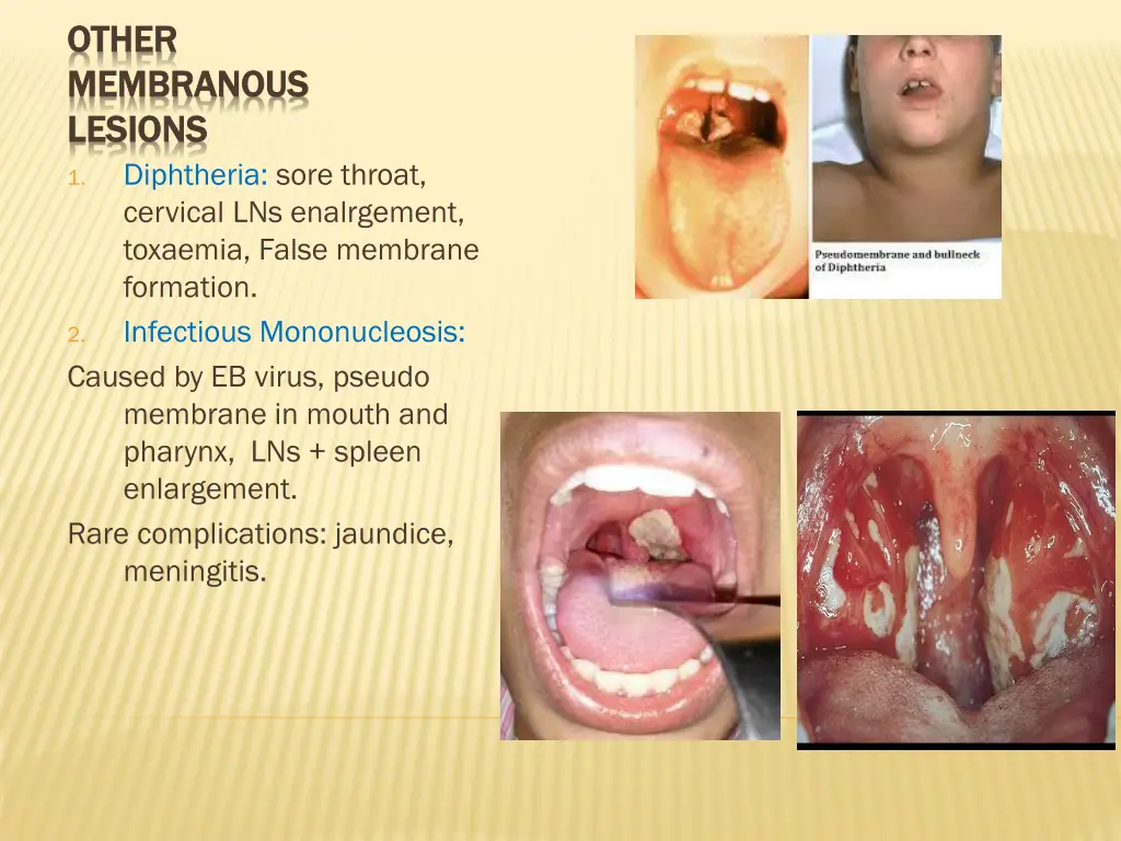 other other membranous membranous lesions lesions