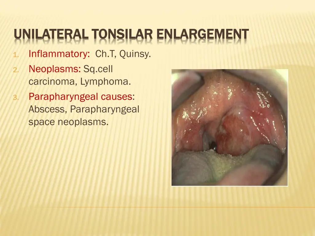 unilateral unilateral tonsilar