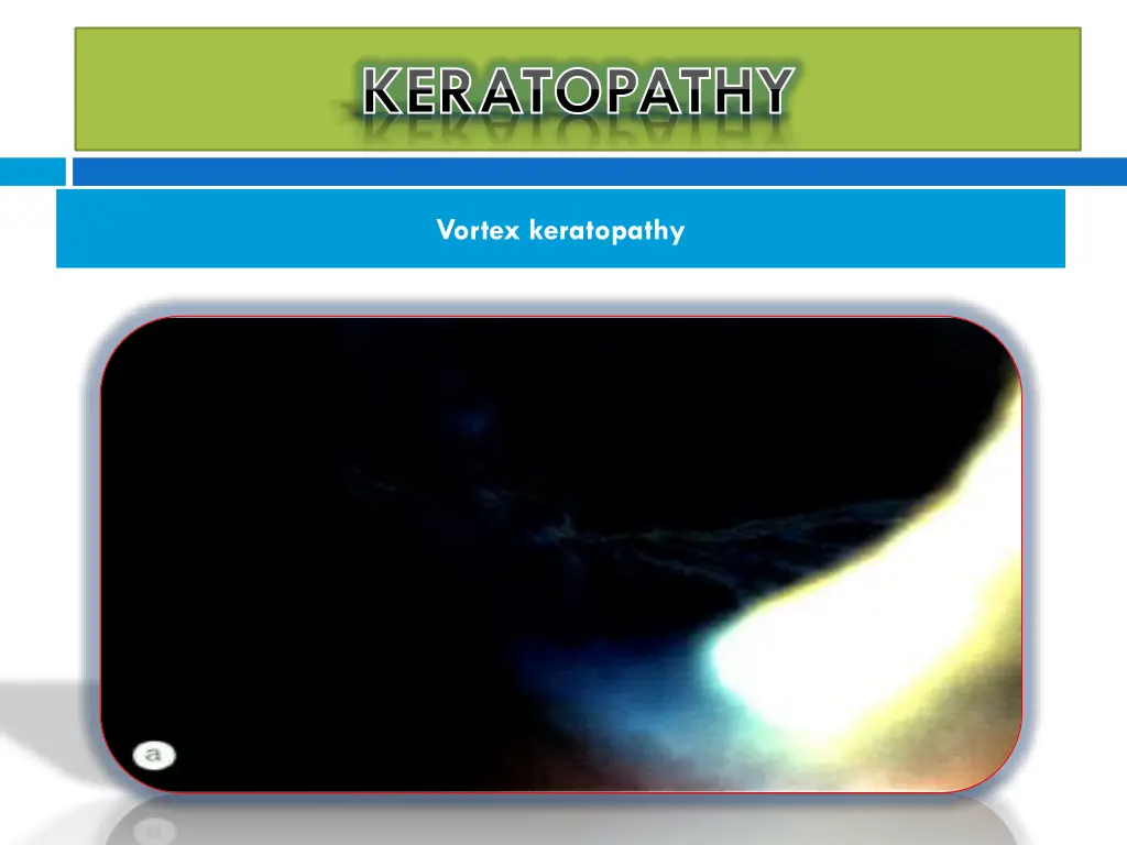 keratopathy keratopathy