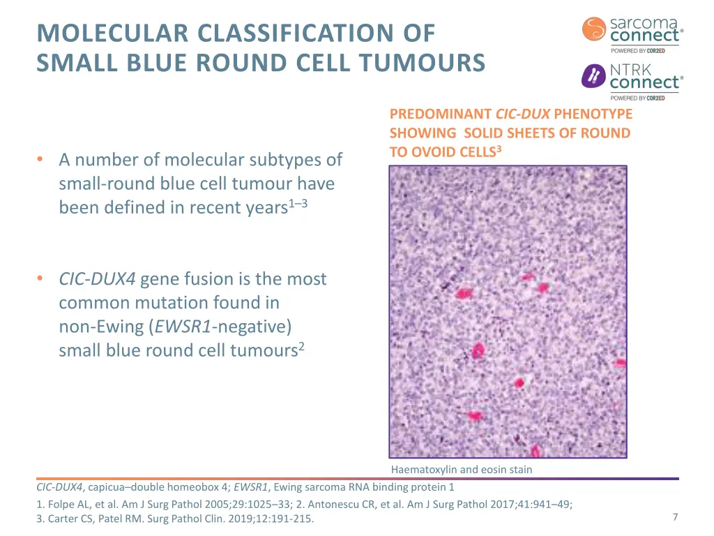 molecular classification of small blue round cell