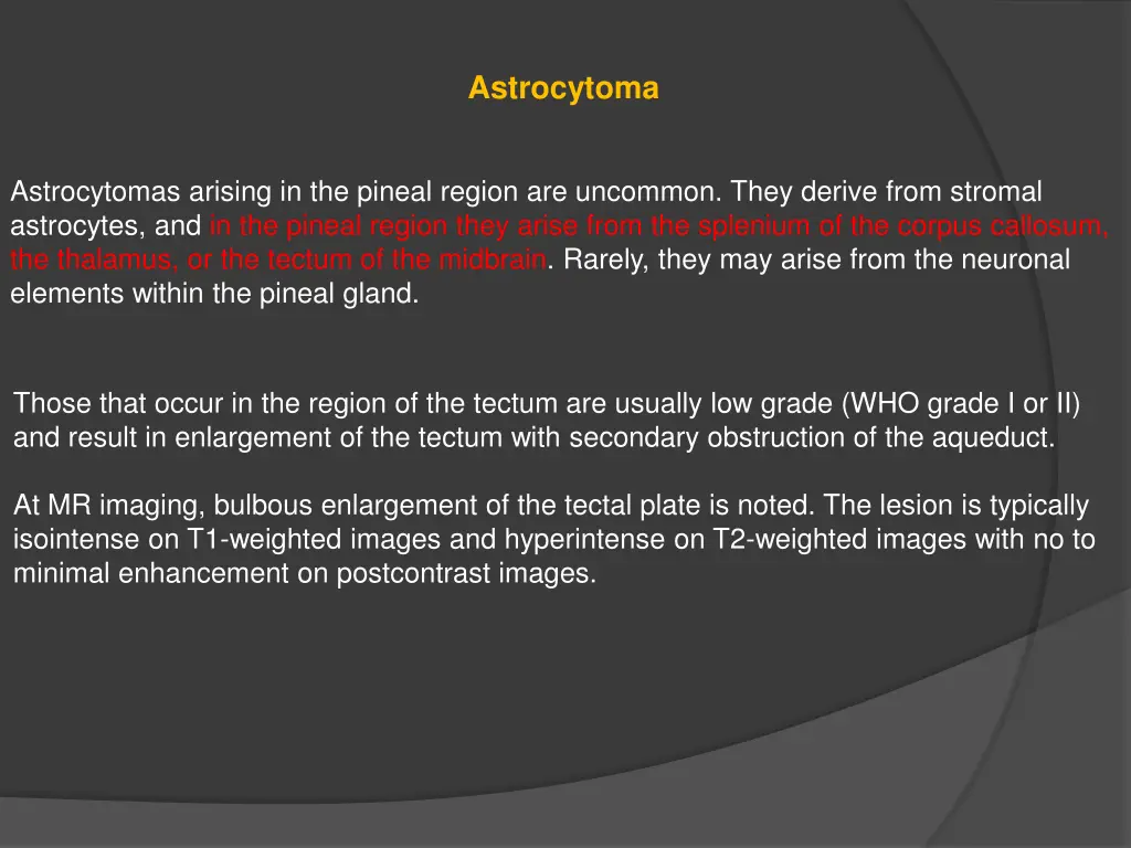 astrocytoma