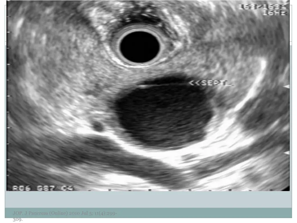 jop j pancreas online 2010 jul 5 11 4 299 309 1