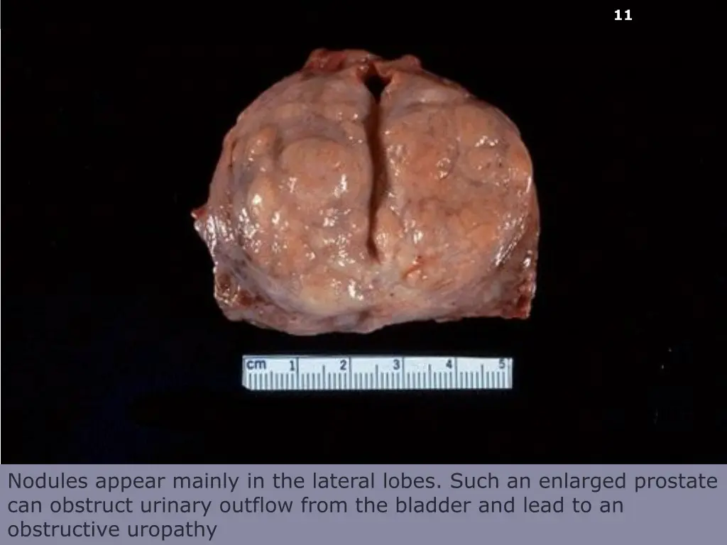 slide11