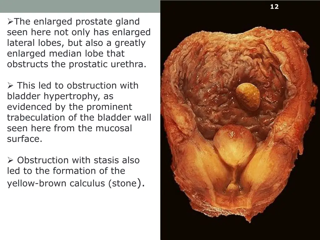 slide12