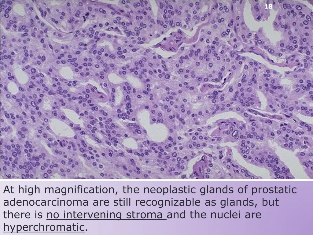 slide18