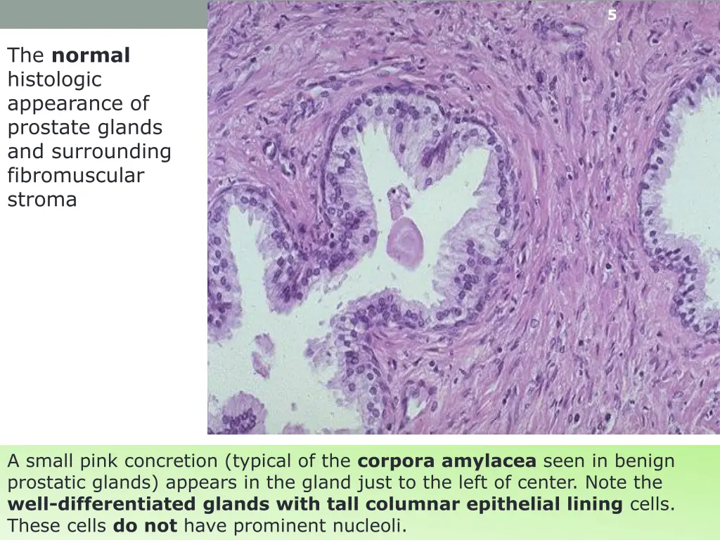 slide5