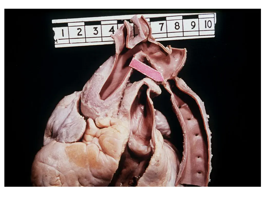 slide27