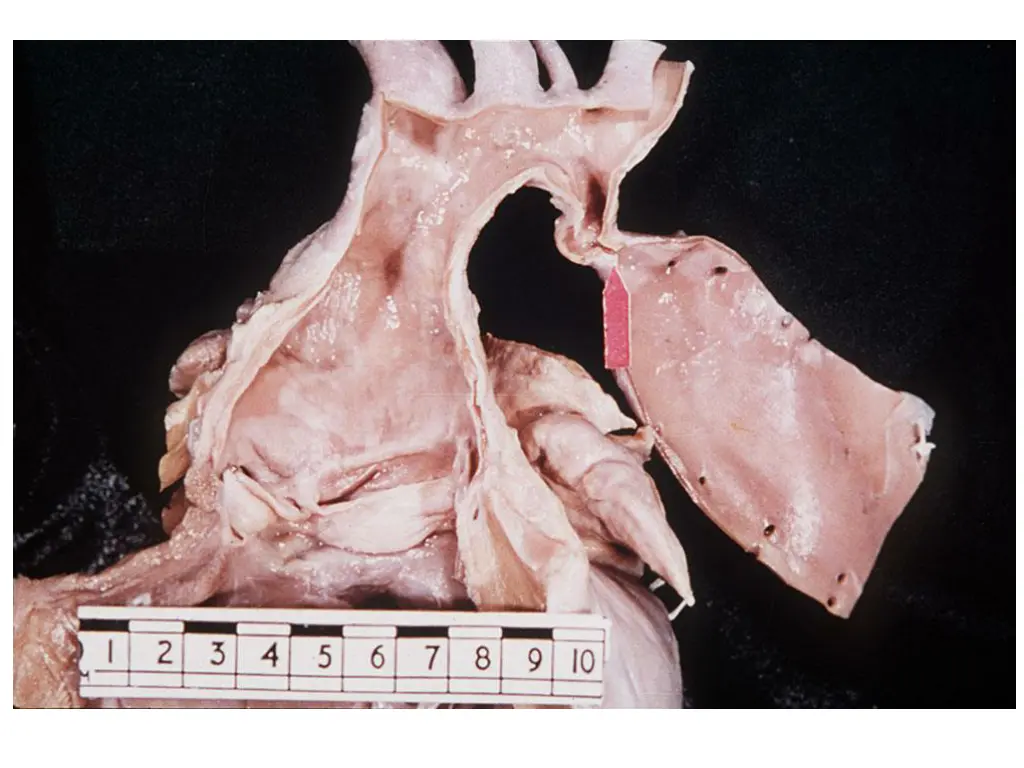 slide28