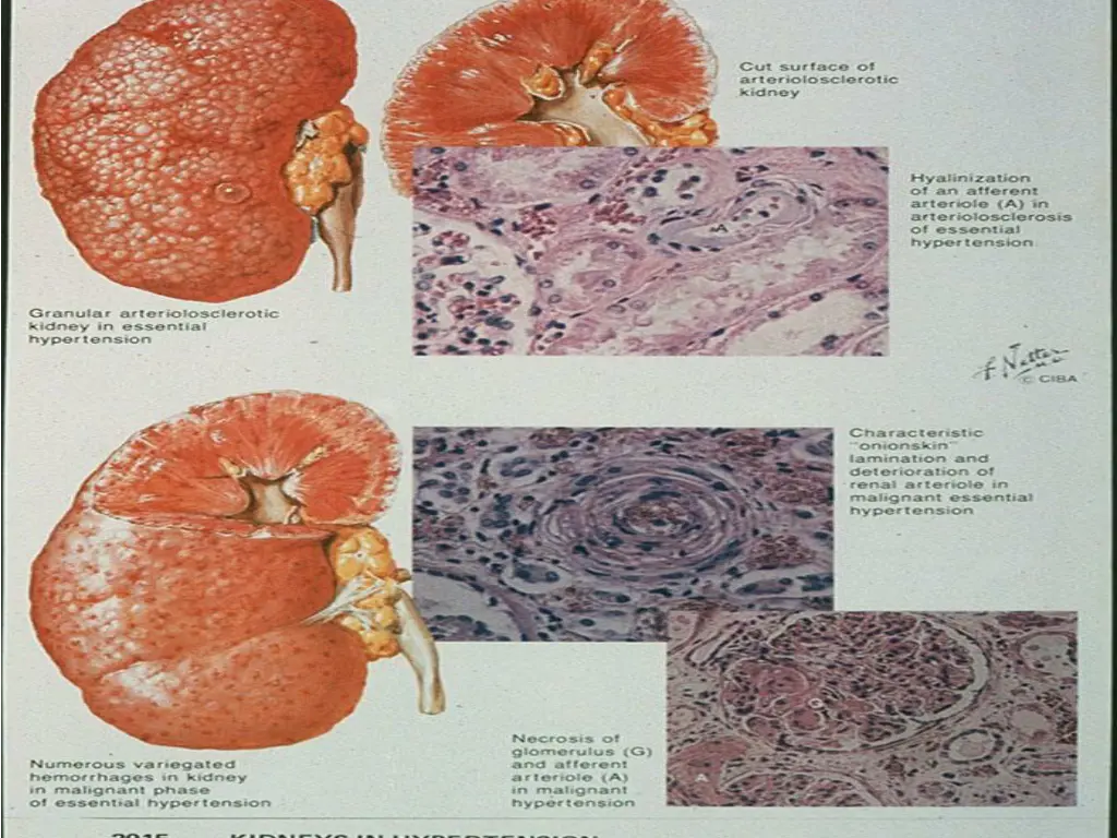 slide7