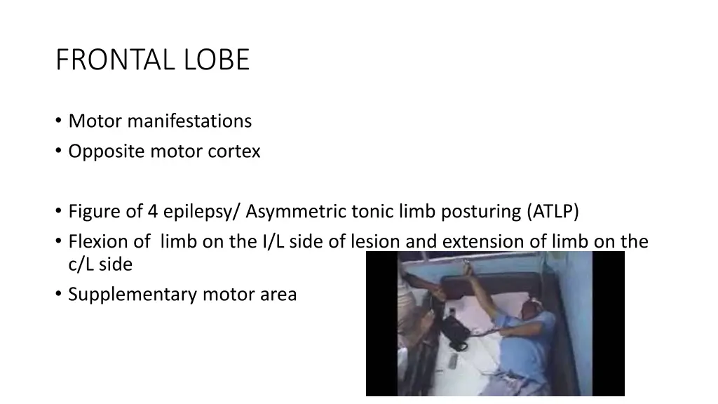 frontal lobe