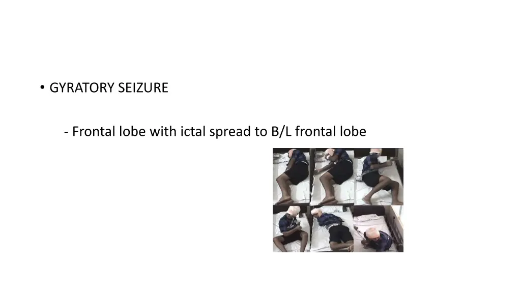 gyratory seizure