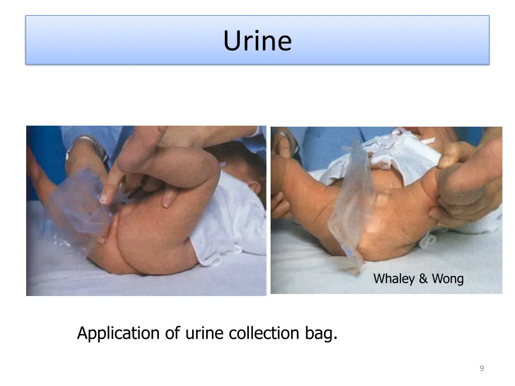urine