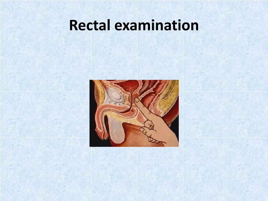 rectal examination 1