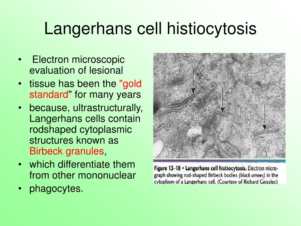 langerhans cell histiocytosis 5