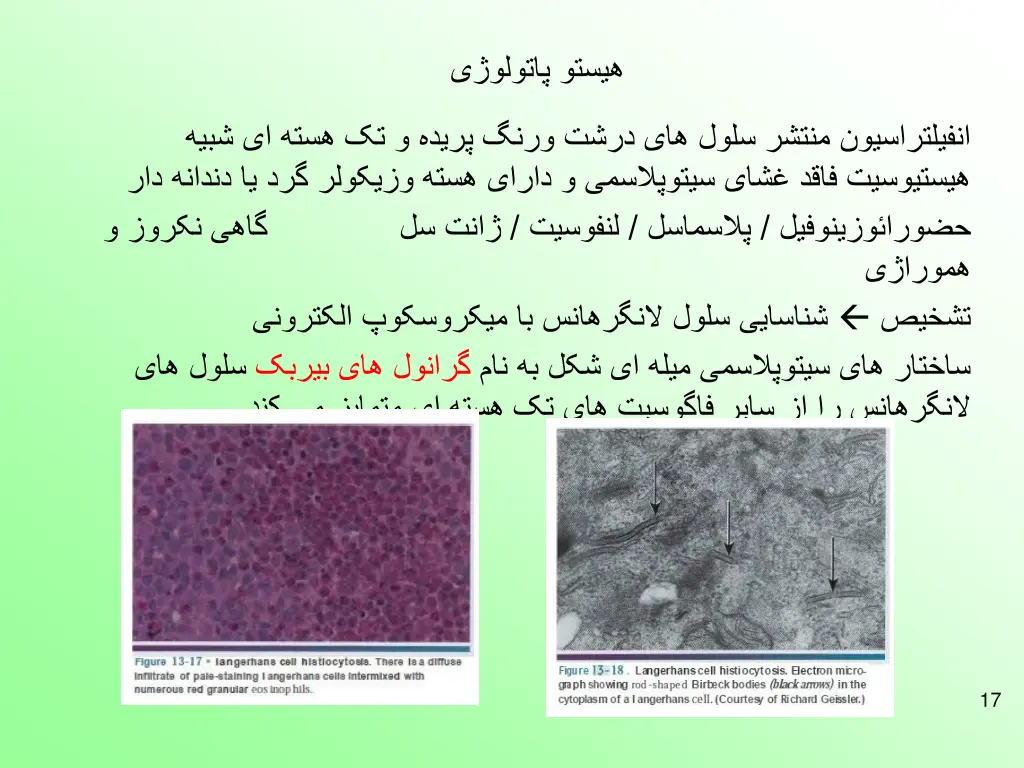 slide17