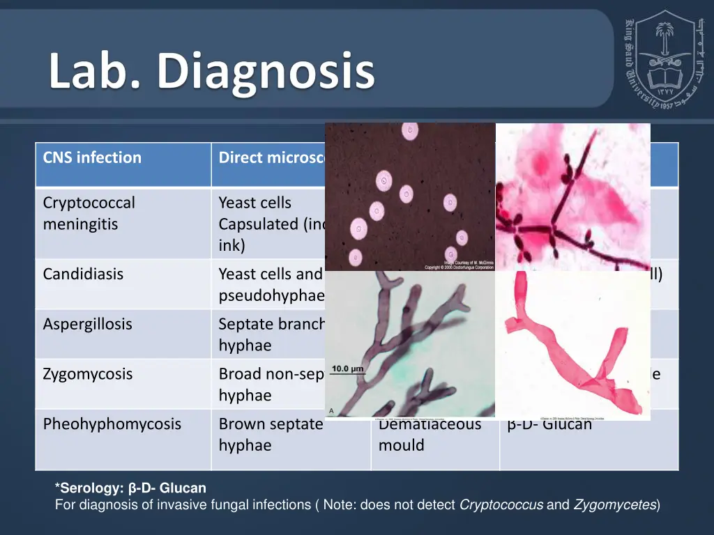cns infection