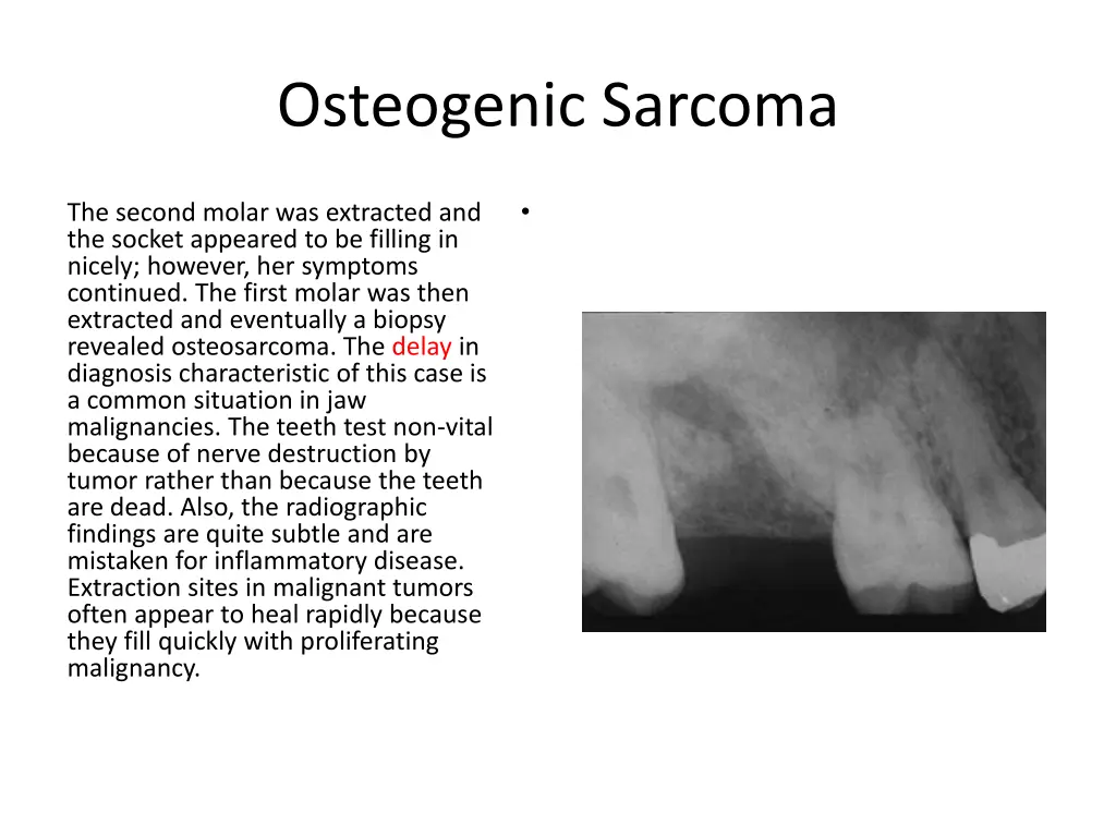 osteogenic sarcoma 9