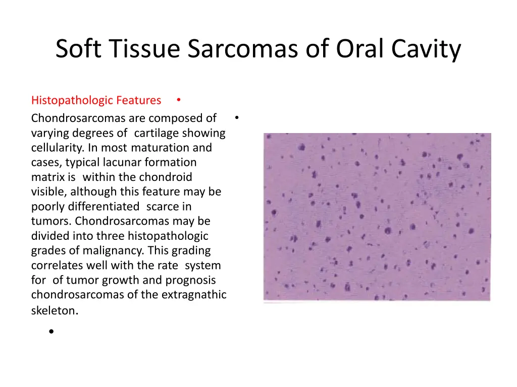 soft tissue sarcomas of oral cavity 11