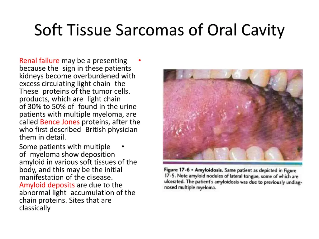 soft tissue sarcomas of oral cavity 16