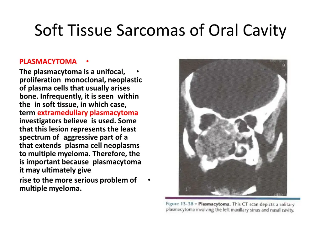 soft tissue sarcomas of oral cavity 19