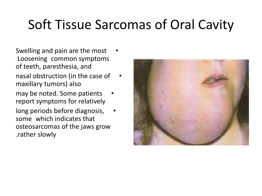 soft tissue sarcomas of oral cavity 3