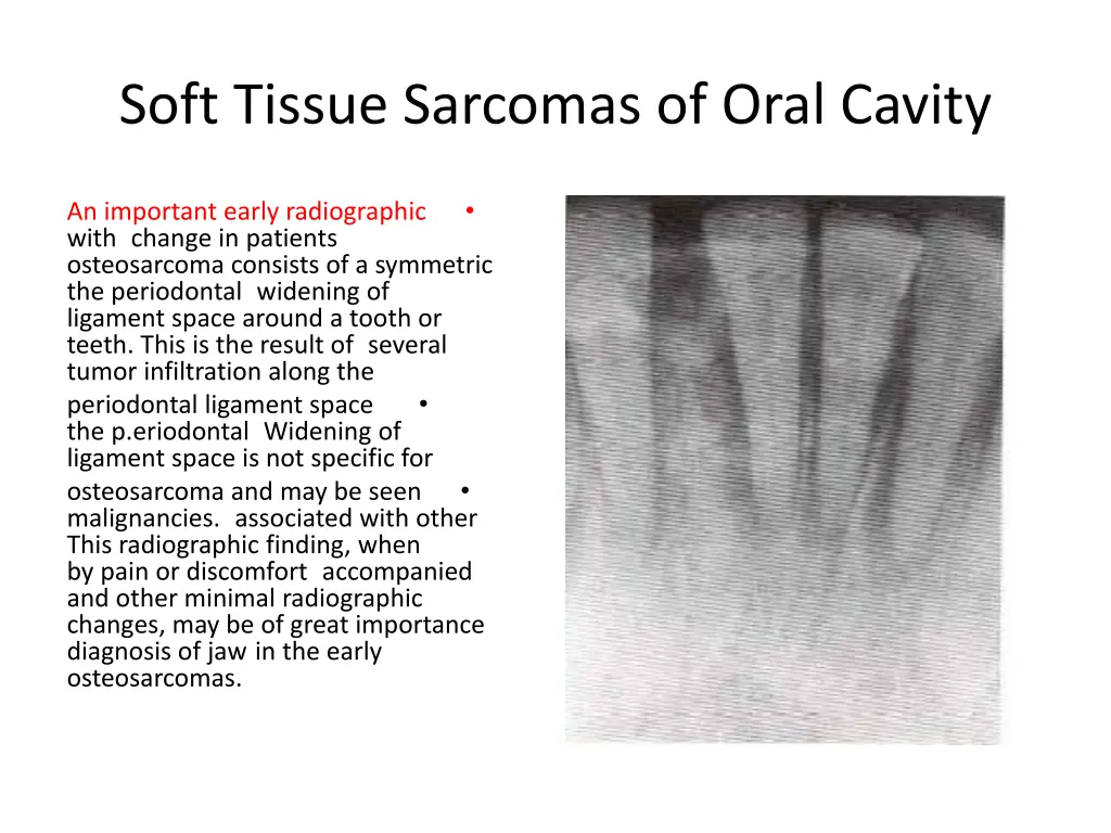 soft tissue sarcomas of oral cavity 6